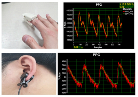 기존 투과형 센서를 통해 얻은 PPG신호(위)와 이어클립형 센서를 통해 얻은 PPG 신호(아래)