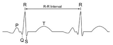 심전도 파형에서의 심박수 검출