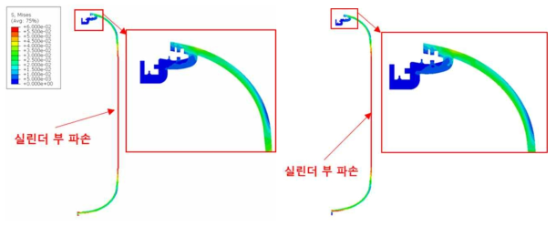 수소저장용기의 Port-Liner 결합 모델 해석 결과 (좌)Knob 구속 조건 (우)Knob 비 구속 조건