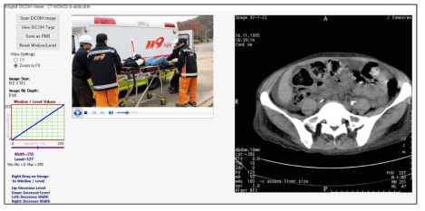 검증 SW를 이용한 응급구조 비디오 DICOM 재생 및 기존 의료정보