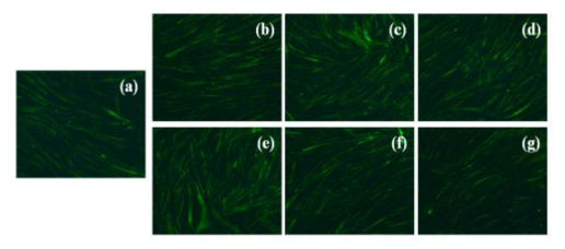 Myosin heavy chain immunofluorescence staining in C2C12 myotubes