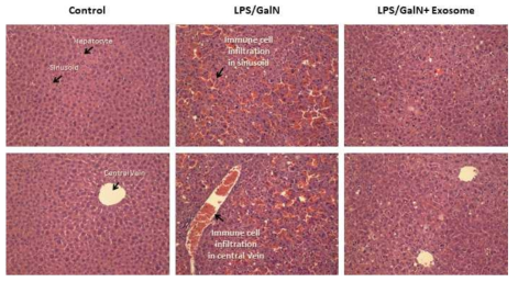 LPS/GalN 급성 간부전 모델에서 Exosome에 의한 면역세포 침착 개선 효과 확인