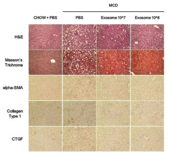 비알코올성 지방간증 모델에서 엑소좀의 효능평가: 조직염색 및 면역조직화학염색