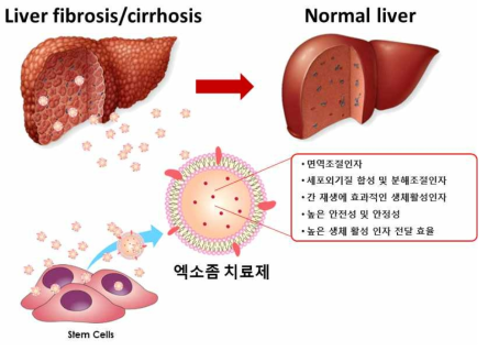 간섬유화/간경변증 치료의 핵심 역할을 하는 줄기세포 엑소좀