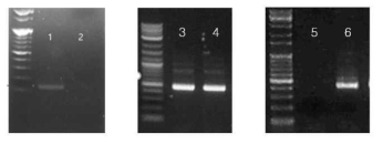 PCR products generated from human RNA(extracted from 293 cell). Target gene, GAPDH(Lane 1, 2), β-globin(Lane 3,4), β-actin(Lane 5,6) was amplified at same annealing temperature(56℃) using a conventional thermal cycler (Thermo scientific, USA), M, molecular weight maker