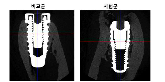 microCT 상 비교군(SLA 처리된 임플란트 고정체) 및 시험군(탄소 나노물질 코팅 임플란트 고정체)의 모습