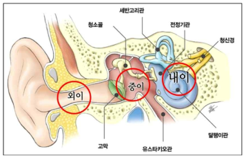 소음성 난청의 발생부위 (내이)