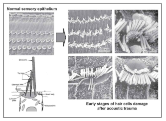 소음에 노출 직후 나타나는 유모세포의 기계적 손상