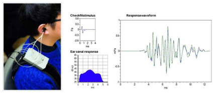 소아에서의 청력측정을 위한 이음향방사검사 (OtoAcoustic Emissions, OAE)