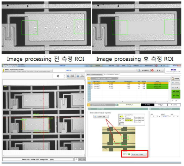 계측 정확도 향상을 위한 image processing 개념 및 설정 UI