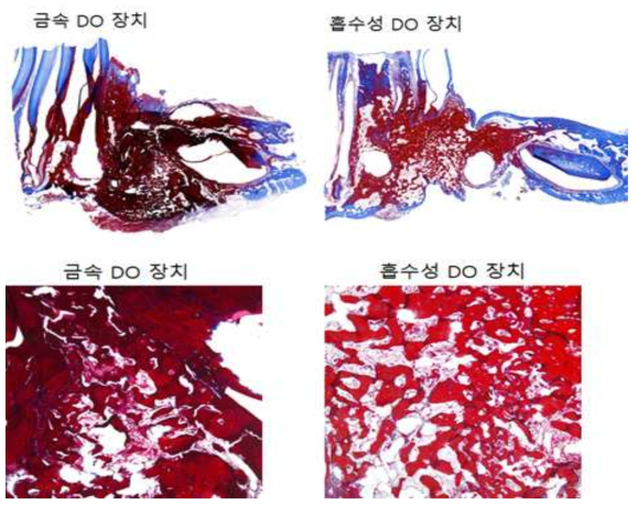 골 신장부의 조직염색 결과 (M&T stain)