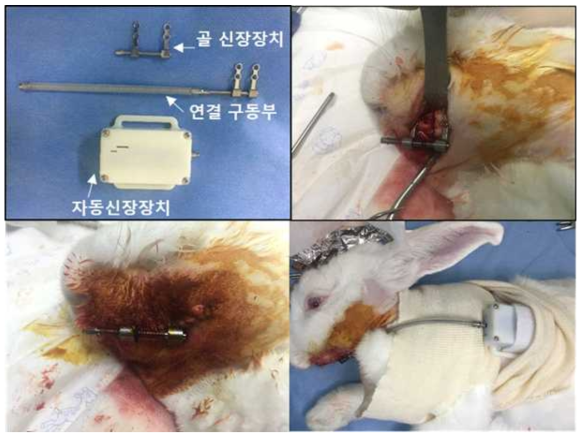 자동 골 신장기 1차 디자인 및 장착모습