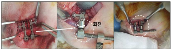 자동 골 신장기 4차 디자인