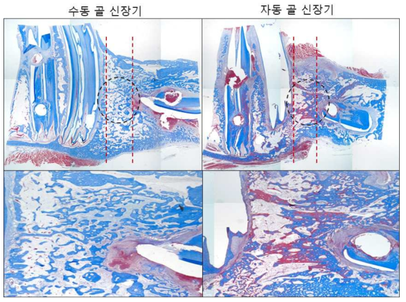 골 신장기 종류에 따라 형성된 신생 골 비교 (M&T stain)