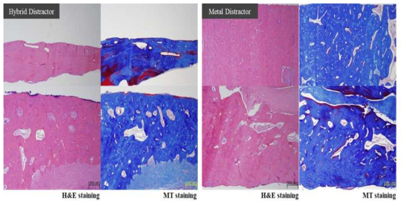 조직염색을 통한 신생 골 형성효과 분석