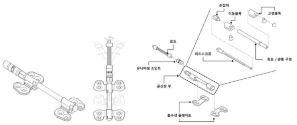 보완된 생분해성 골 신장기 시안 및 해부도