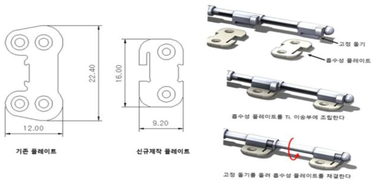 Upgrade된 하이브리드 골 신장기의 플레이트 크기비교 및 채결원리