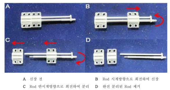 두개골용 하이브리드 골 신장기 비수술적 분해도