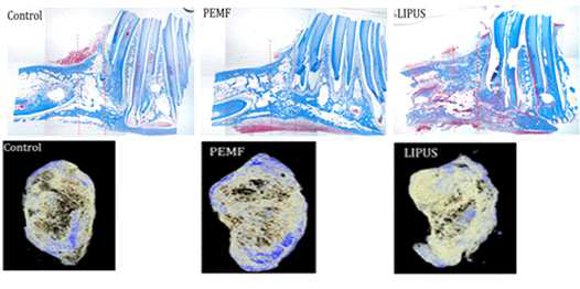 PEMF/LIPUS 자극에 따른 조직염색 및 Micro CT 결과