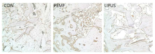 PEMF/LIPUS 자극에 따른 VEGF 면역염색 결과