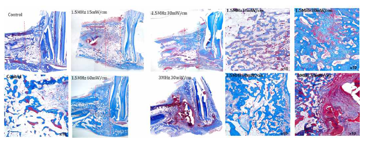LIPUS 자극세기에 따른 신생 골 형성분석 (M&T stain)