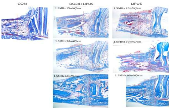 LIPUS 자극세기에 따른 신생 골 형성분석 (M&T stain)