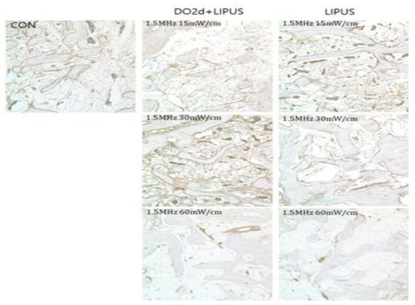 LIPUS 자극세기에 따른 VEGF 면역염색 결과