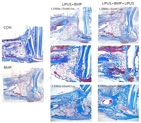 LIPUS 자극과 BMP-2 처리에 따른 골 형성능 분석 (M&T stain)