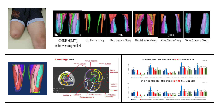 3D Reconstruction 자료 및 근육별 용적 비교