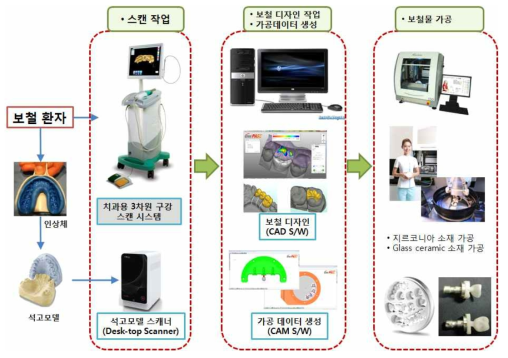 치과용 3차원 구강 스캔 시스템의 적용 분야