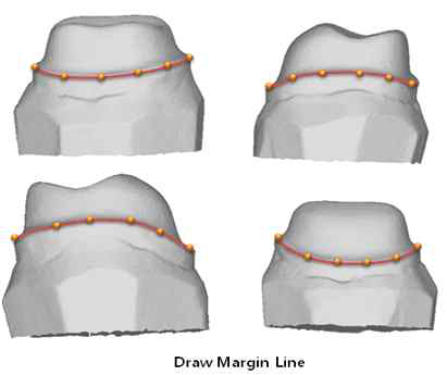 3D 데이터에 표현한 Margin Line