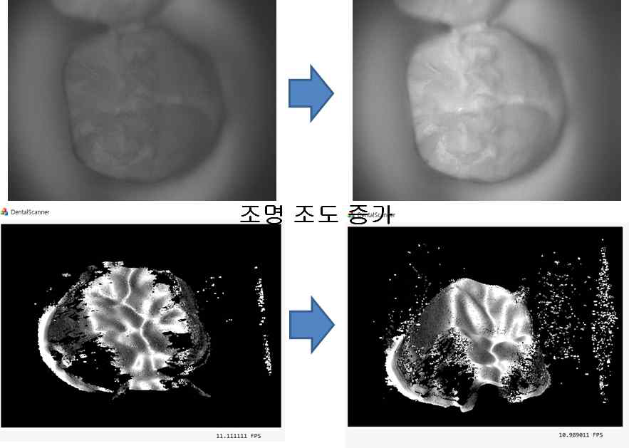 구강스캐너 조명모듈 최적화에 따른 치아영상과 치아 3D 모델 획득 성능 변화