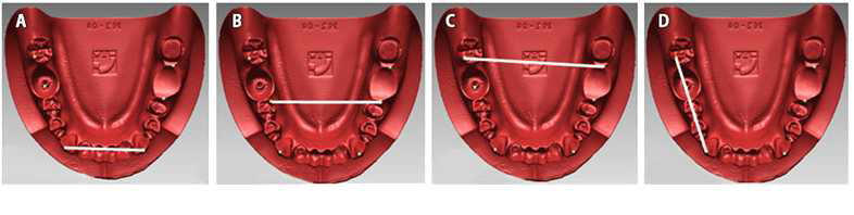 The positions of the measurement parameters. A: D3, B: D6, C: D7, D: D37