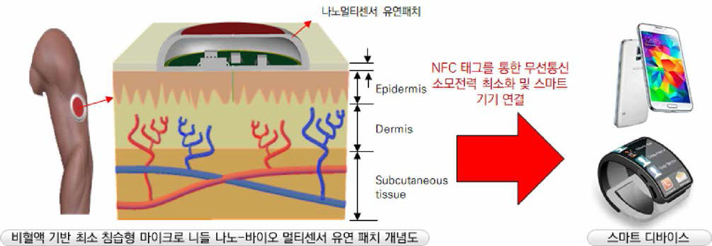 최소 침습형 나노-바이오 멀티센서 유연패치 사용 개념도