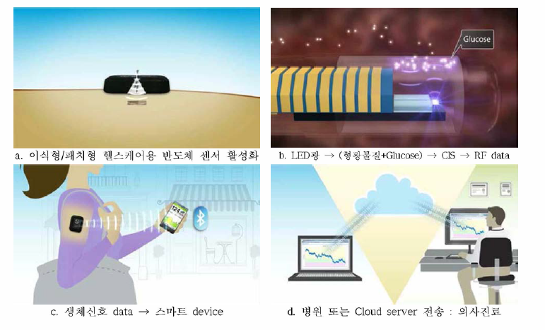 이식형/패치형 헬스케어용 반도체 센서(Photo sensor 또는 CMOS image sensor) 활용