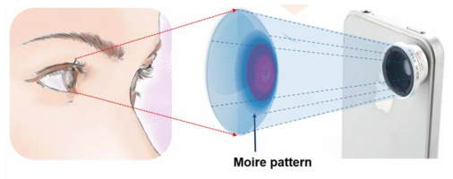 모아레 패턴을 이용한 안압변화 감지 모식도