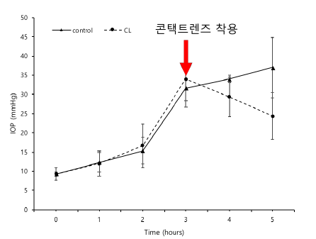 급성 녹내장 모델 및 치료용 콘택트렌즈 착용시 안압변화