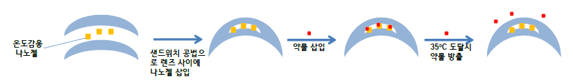 렌즈 사이에 삽입되는 온도감응 나노젤 및 탑재된 약물의 온도감응 방출 모식도