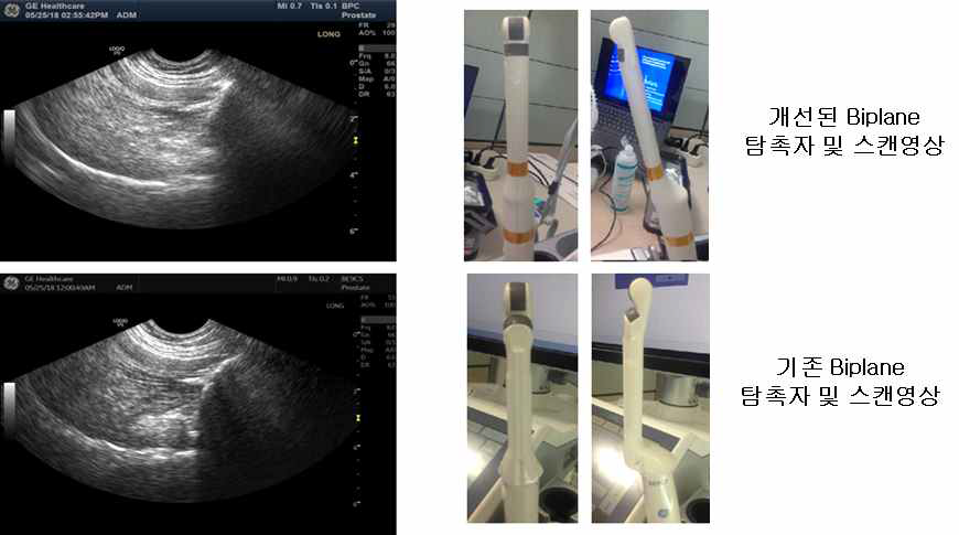 개선된 Biplane 프로토 탐촉자 및 기존 Biplane 탐촉자의 영상화질
