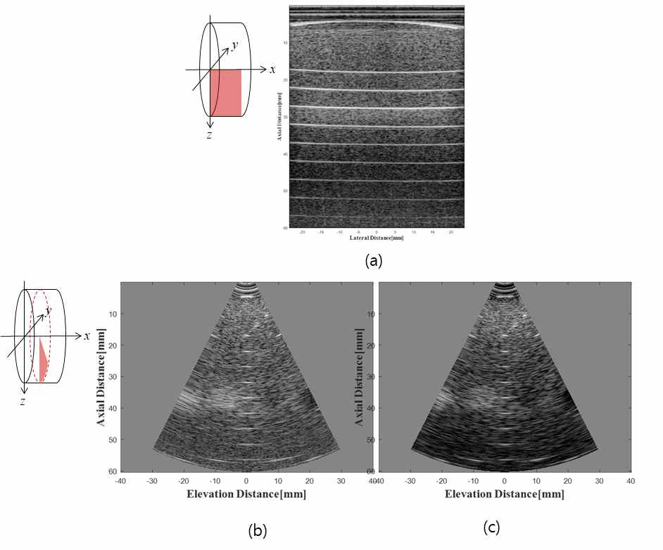 Anorectal 탐촉자 시제품을 사용하여 획득한 팬텀 영상 (a) longitudinal plane 영상 (b) 일반적인 방법의 transverse plane 영상 (c) synthetic aperture 기술이 적용된 transverse plane 영상