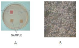 세포독성 시험 및 결과. A: 시편의 탈색 평가를 위한 대조군 및 시험군, B: 세포독성이 존재하는 시편의 현미경 소견
