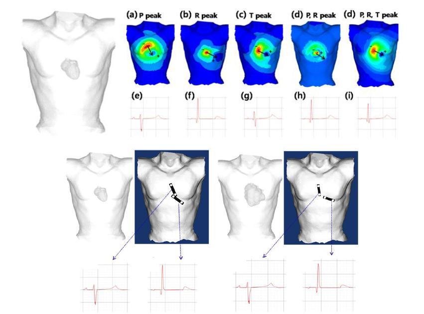 단 채널 심전도 측정 최적의 위치 시뮬레이션 결과