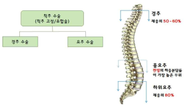 척추 관련 수술의 분류 및 요구되는 하중