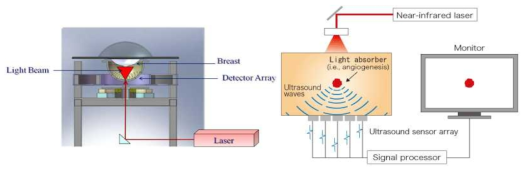 유방질병 진단 전용으로 개발한 OptoSonics 사(좌측)와 Canon 사(우측) 제품의 개념도