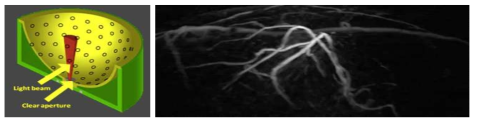 OptoSonics 사의 유방질병 진단용 광음향 영상기기에 장착되어 있는 광음향 영상용 센서 모식도(좌측)와 이를 통해 획득한 광음향 혈관영상(우측)