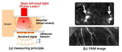 Canon 사의 유방질병 진단용 광음향 영상기기에 장착되어 있는 광음향 영상용 센서 모식도(좌측)와 이를 통해 획득한 광음향 혈관영상(우측)
