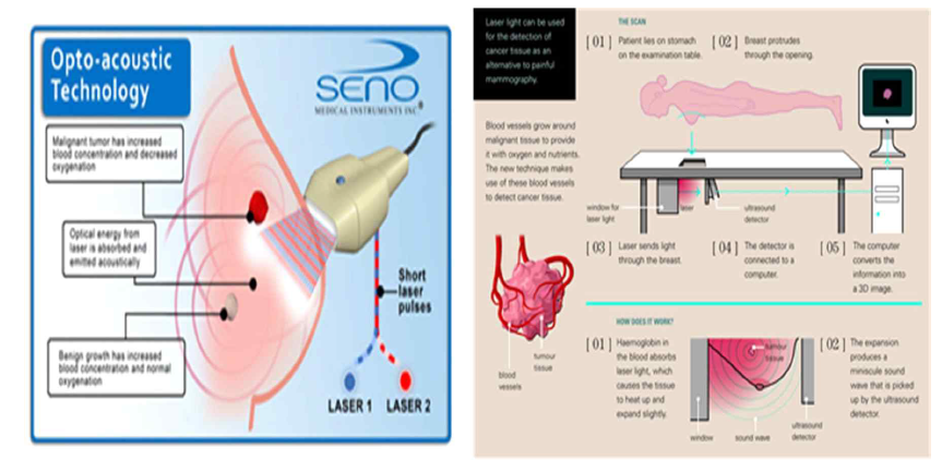 유방암 진단을 위한 광음향 영상 프로브 예시