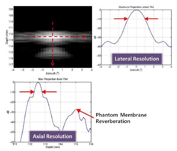 wire target 초음파 영상을 이용한 영상 해상도 측정 예시