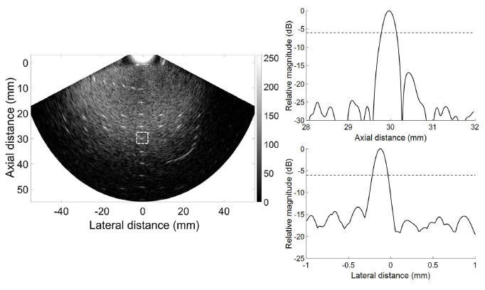 인체조직모사팬텀을 통해 획득된 초음파 영상(왼쪽)과 30 mm에서의 축(오른쪽-위)/측(오른쪽-아래)방향 영상 해상도