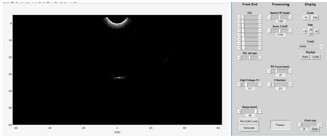 KTL 위탁 시험에 사용된 영상 데이터: (왼쪽) Verasonics 영상, (오른쪽) 실험 Parameter 설정